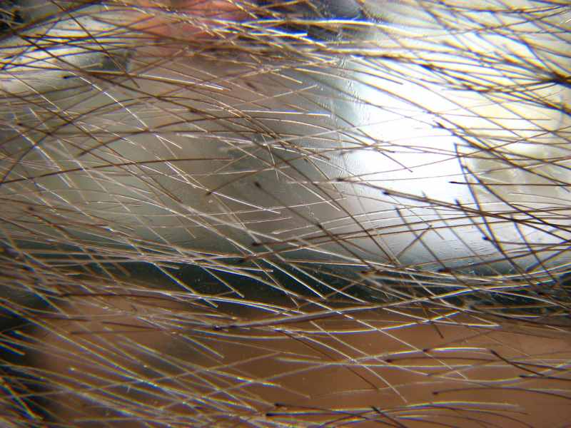 Tipos de Alopecia
