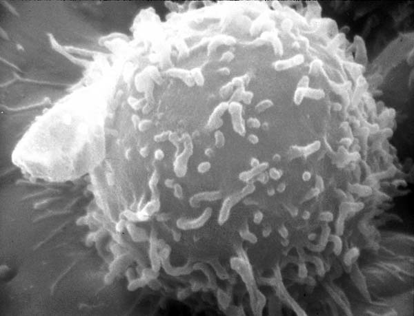 Celula cancerigena