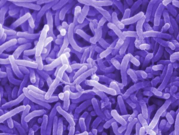 Bacteria del colera