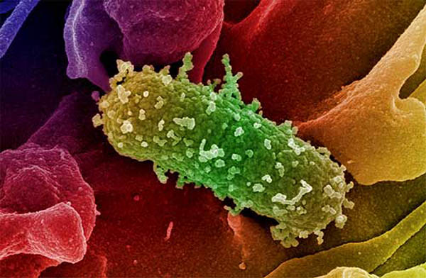 Enteritis por E. coli