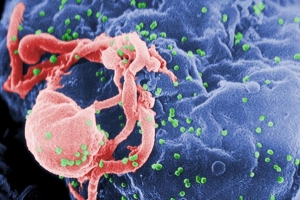 HIV - Herpes - Gel anticontagio