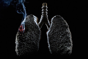 Cáncer al pulmón