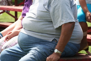 El cinturón gástrico es uno de los tratamientos para la obesidad