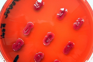 El brote de E. coli ocurrido en Europa es de una nueva cepa 