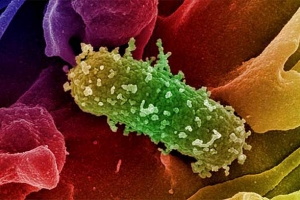 Enteritis por E. coli