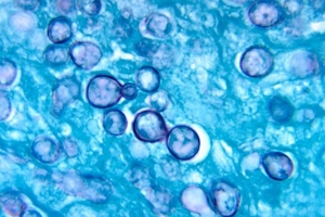 Hongo Histoplasma capsulatum 