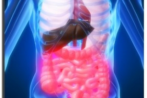 Sindrome de colon irritable 