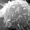 Celula cancerigena
