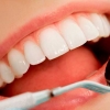Alimentos que protegen los dientes y encías