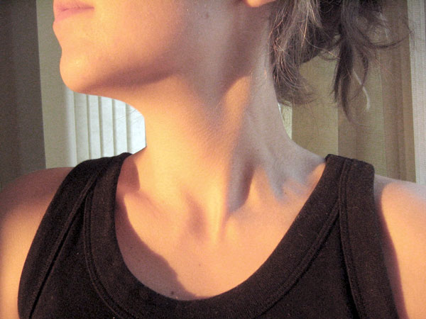 Tumores de tiroides
